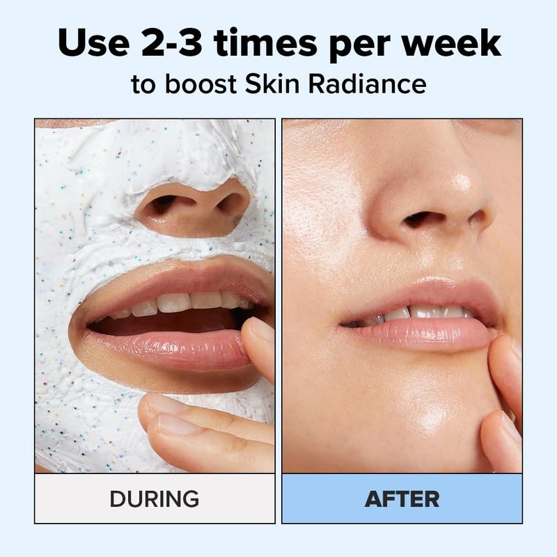 I DEW CARE Wash Off Face Mask - Cake My Day | With Hyaluronic Acid, Self Skin Care, Facial Treatment, Vegan, Cruelty-Free, Paraben-Free, Exfoliating, Deep Cleansing Detox, Stocking Stuffers, 3.38 Oz