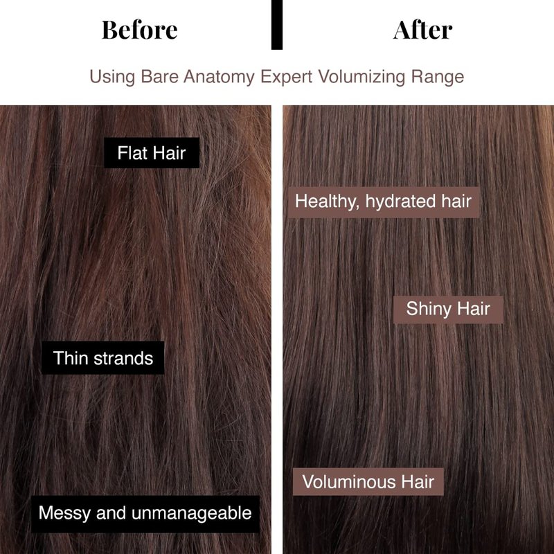 Bare Anatomy Volumizing Shampoo | For Fine Hair - Adds Lift & Body, Volumizing & Detangling Without Weighing Down | Paraben & Sulphate Free | Women & Men | 8.4 Ounce