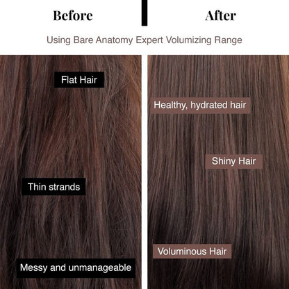 Bare Anatomy Volumizing Shampoo | For Fine Hair - Adds Lift & Body, Volumizing & Detangling Without Weighing Down | Paraben & Sulphate Free | Women & Men | 8.4 Ounce