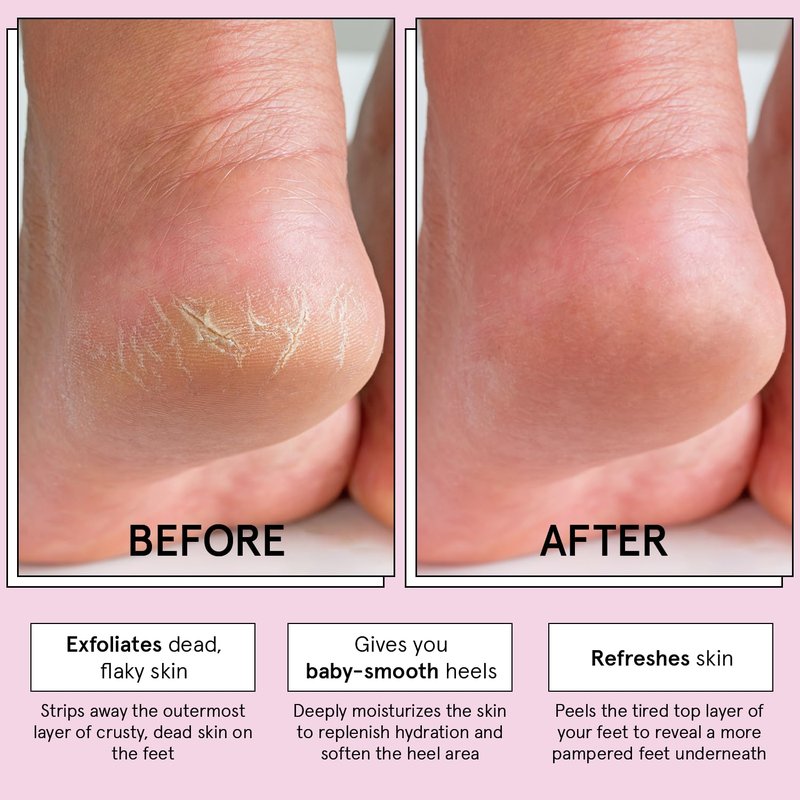 Award-Winning Foot Peeling Mask - Dr. Pedicure Foot Peel Masks (2 Pairs, Lemon) - Moisturizing Foot Masks That Remove Dead Skin, Exfoliating Foot Mask for Dry Cracked Feet, Feet Peeling Mask