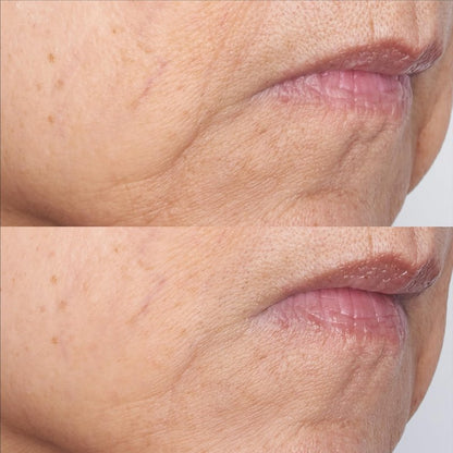 Cold Plasma Plus+ The Intensive Gel Mask, 2 fl. oz.