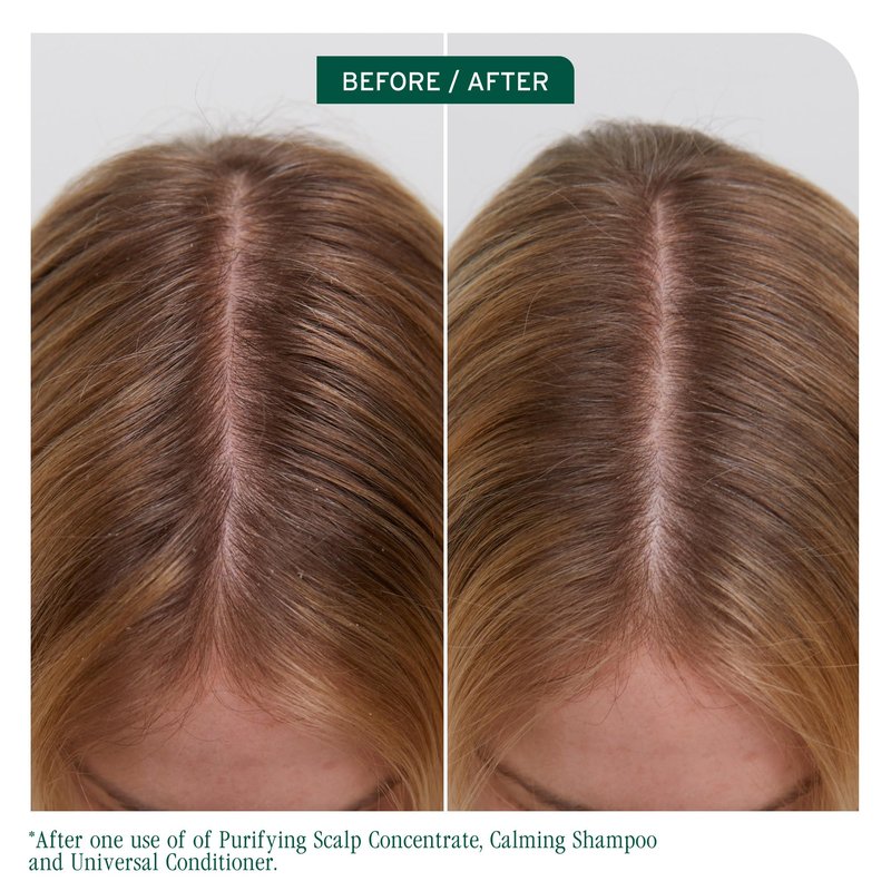 Biolage Scalp Sync Calming Shampoo - Gently Cleanses Dry & Sensitive Scalps, Hydrates & Soothes, Fermented Tea Blend & Glycolic Acid, Vegan & Paraben-Free